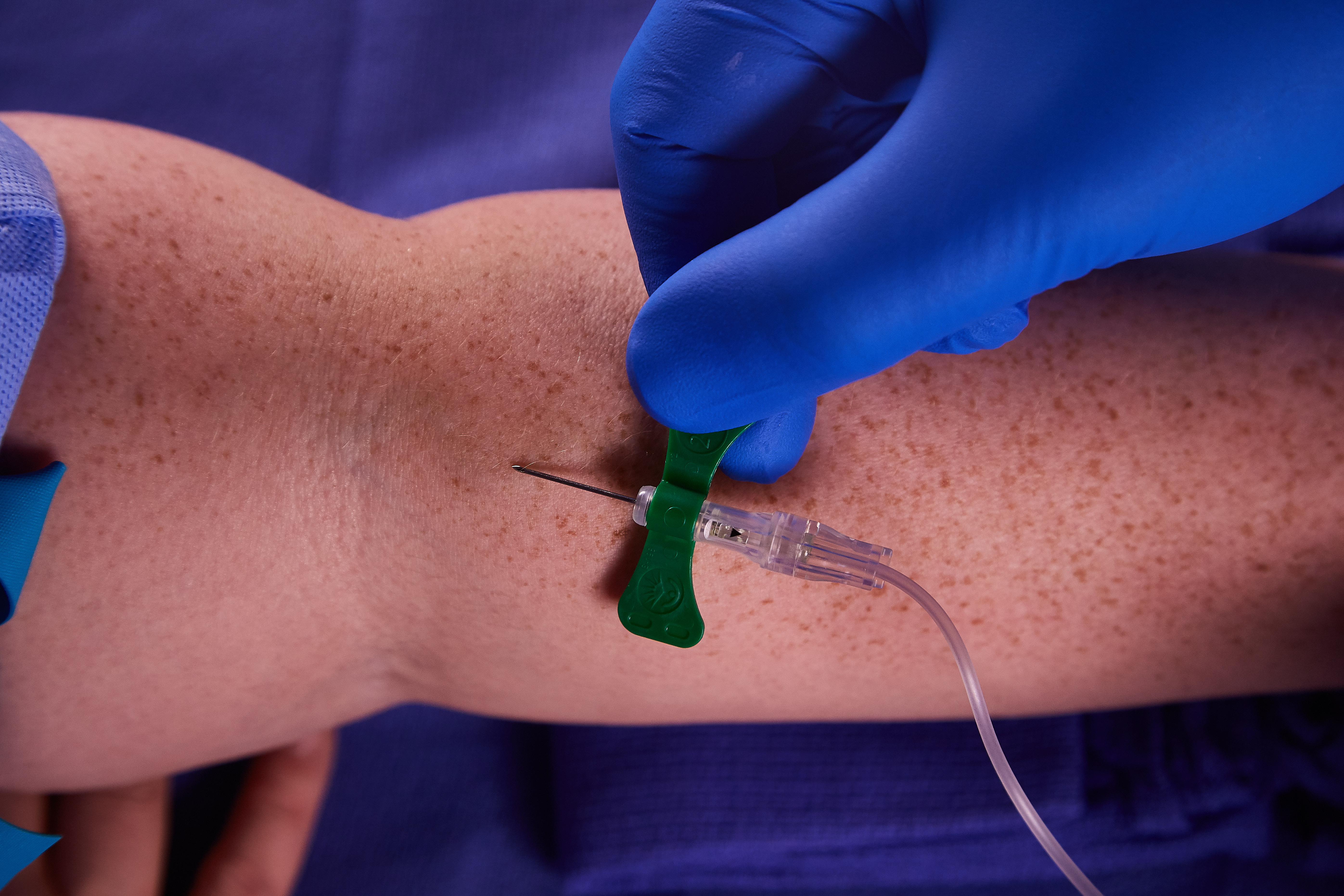 no vein viewer