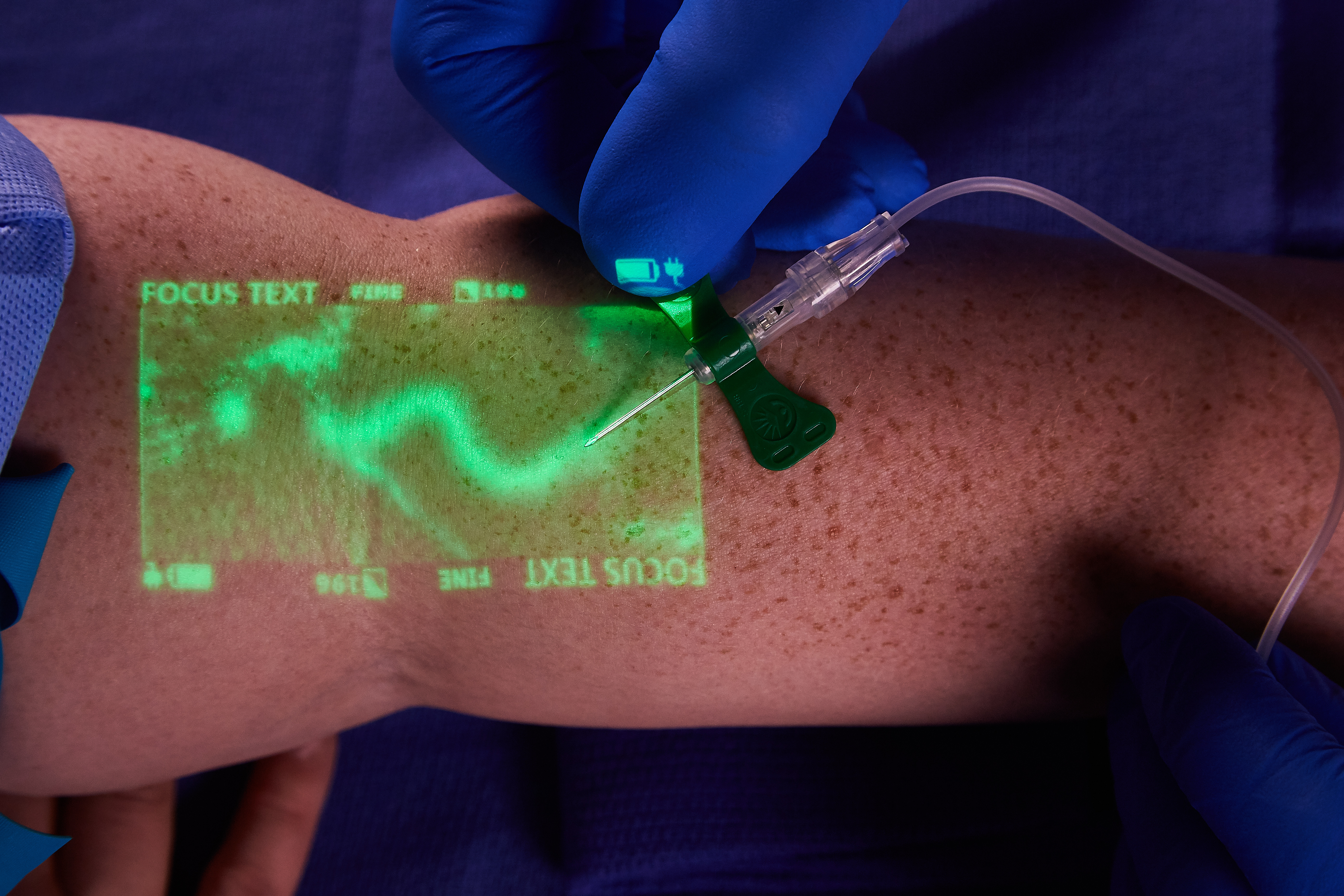 with vein viewer